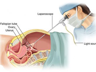 laparoscopicsurgery