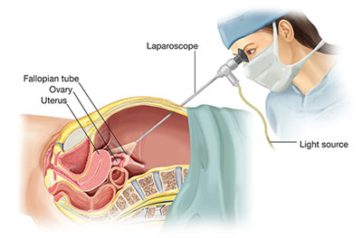 laparoscopicsurgery